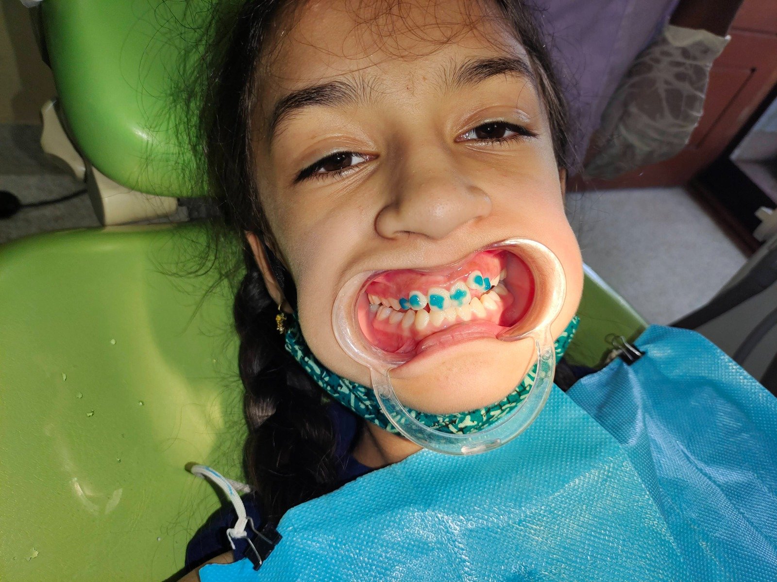 13. Pediatric Dentistry & Child Dental Care - After