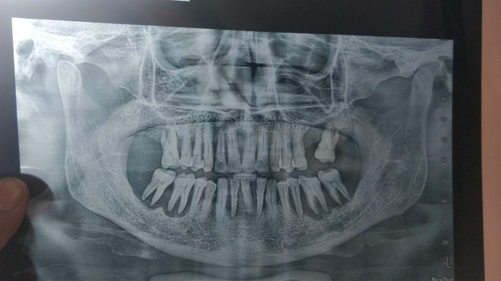 2. Digital Dental X-Ray & OPG