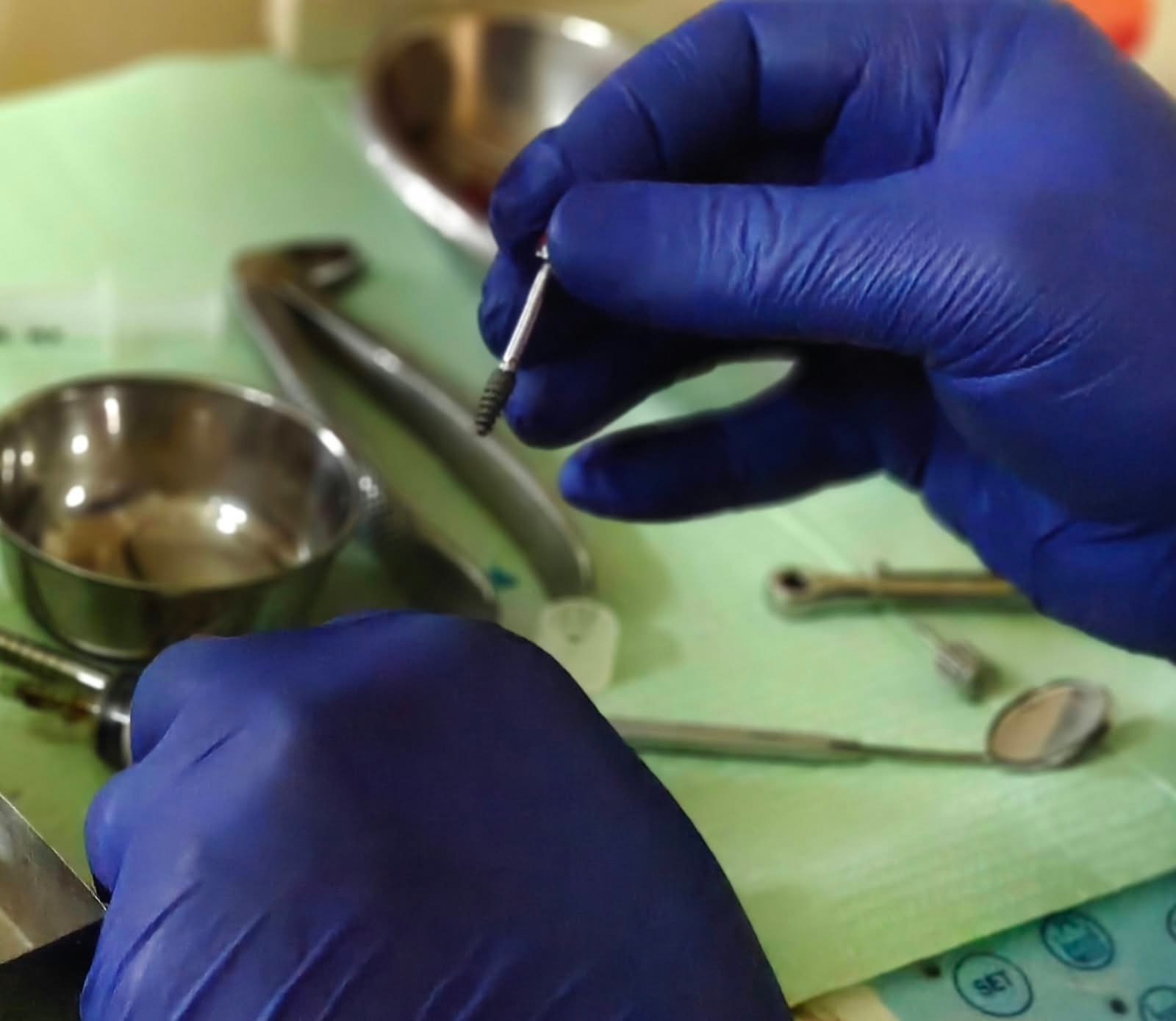 8. Advanced Dental Implants & Fixed Teeth - Before